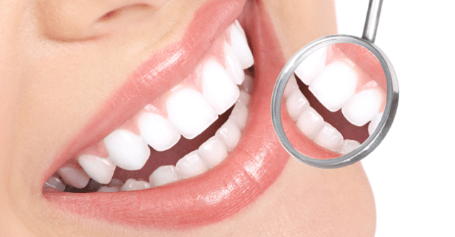 Dental Crowns FairFax