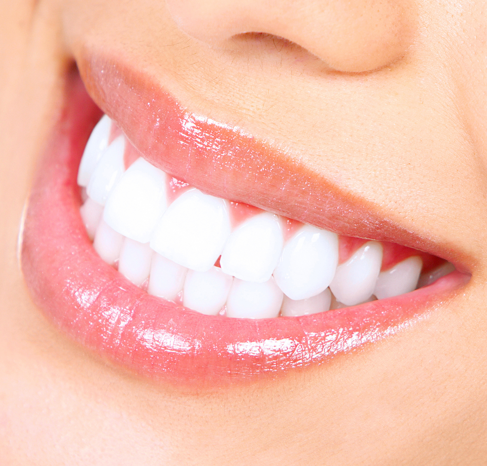 Teeth Whitening FairFax, VA